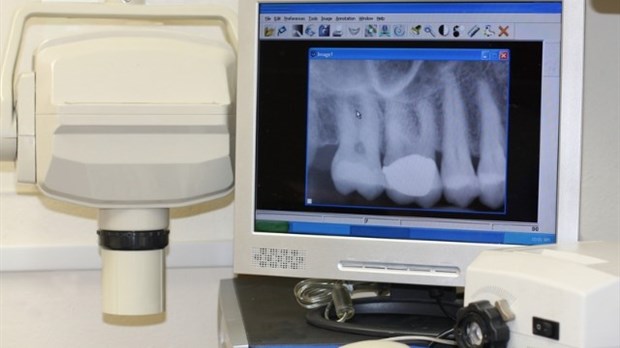 Radiographies dentaires : types et utilités