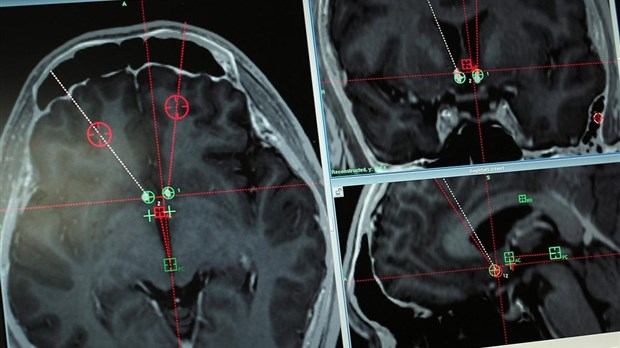 Nouvelle étude sur la santé cognitive des aînés