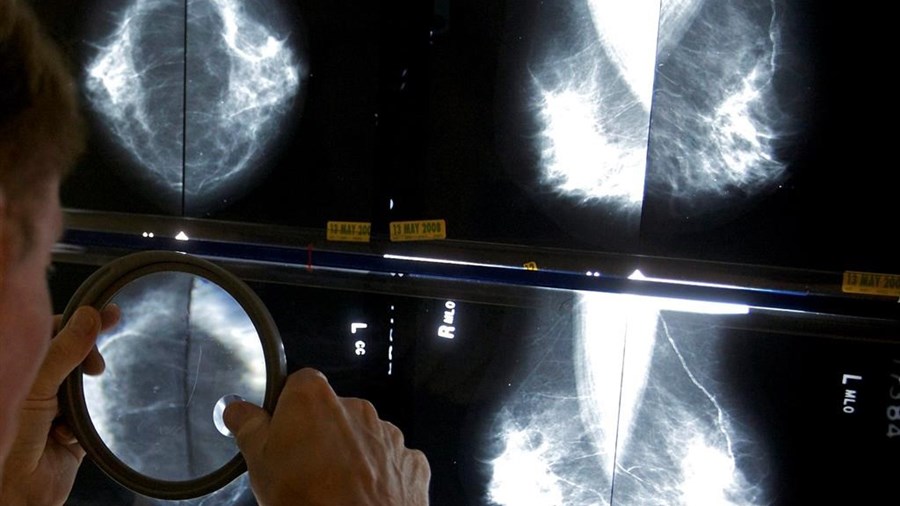 La Société canadienne du cancer réclame le dépistage du cancer du sein dès 40 ans