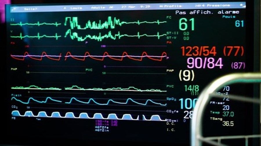 Facteurs de risque de maladies du cœur et d'AVC: des tendances préoccupantes