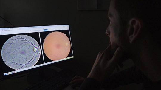 Une analyse de la rétine pourrait permettre de dépister une centaine de maladies