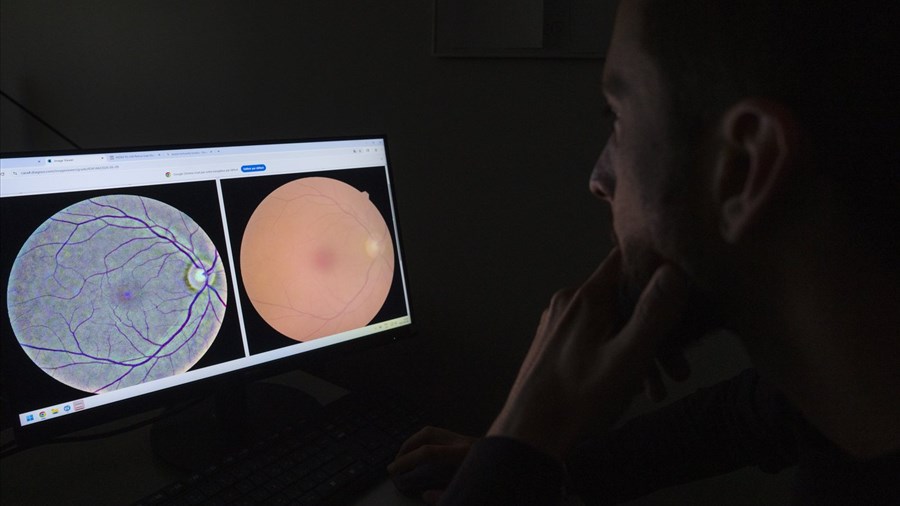 Une analyse de la rétine pourrait permettre de dépister une centaine de maladies